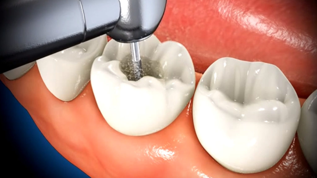 Dr.Nadeer's Fathima Dental Care Vengara