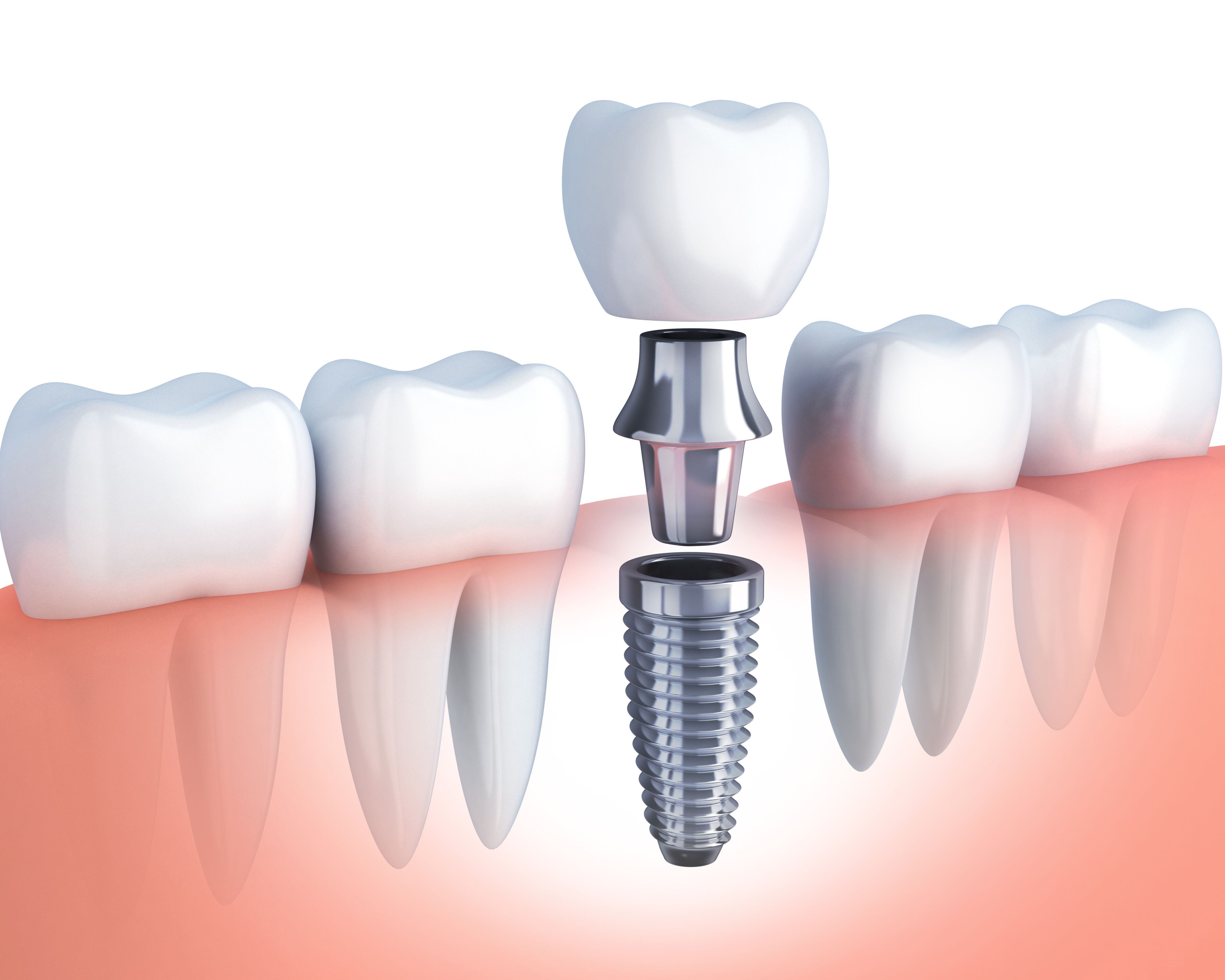 Dr.Nadeer's Fathima Dental Care Vengara