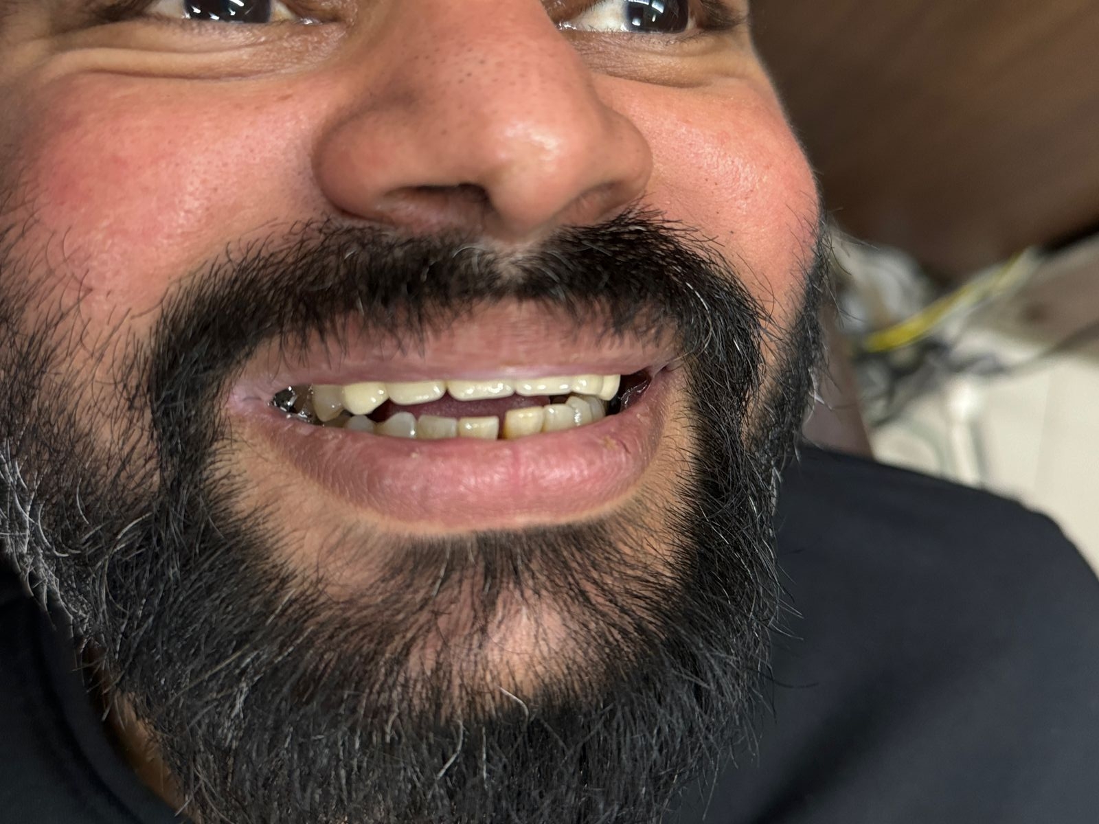 Dr.Nadeer's Fathima Dental Care Vengara