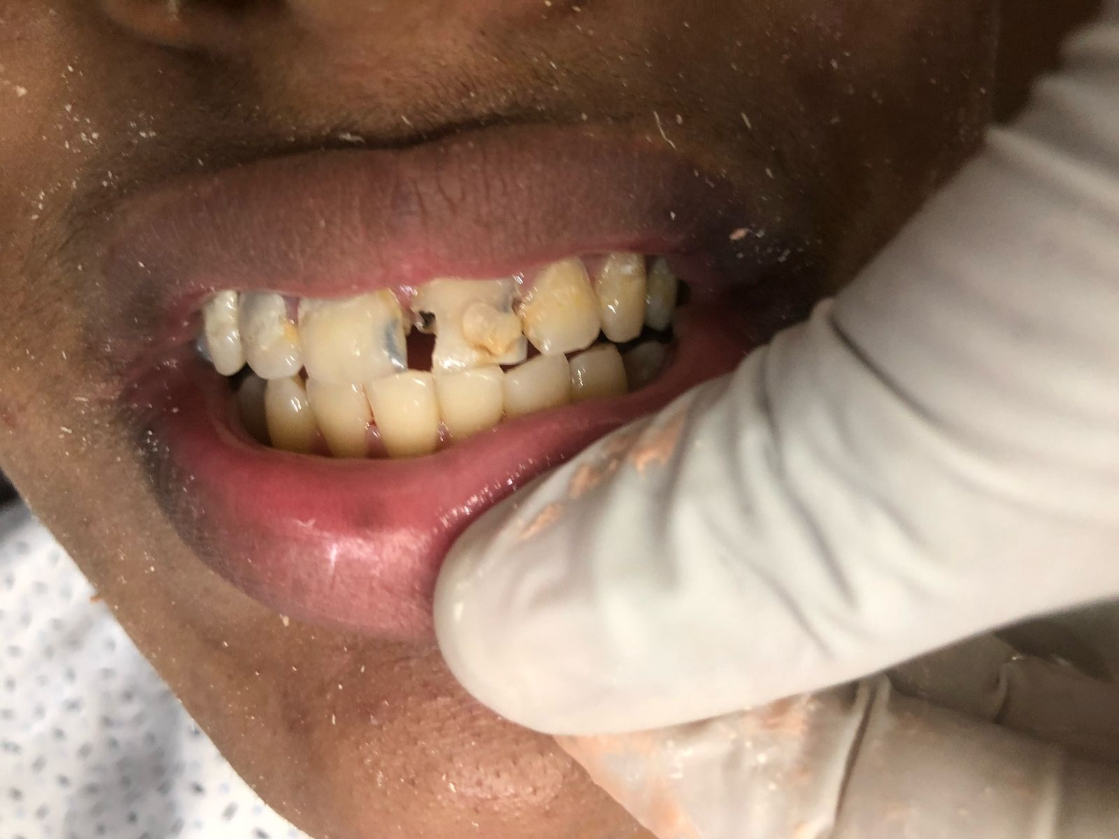 Dr.Nadeer's Fathima Dental Care Vengara