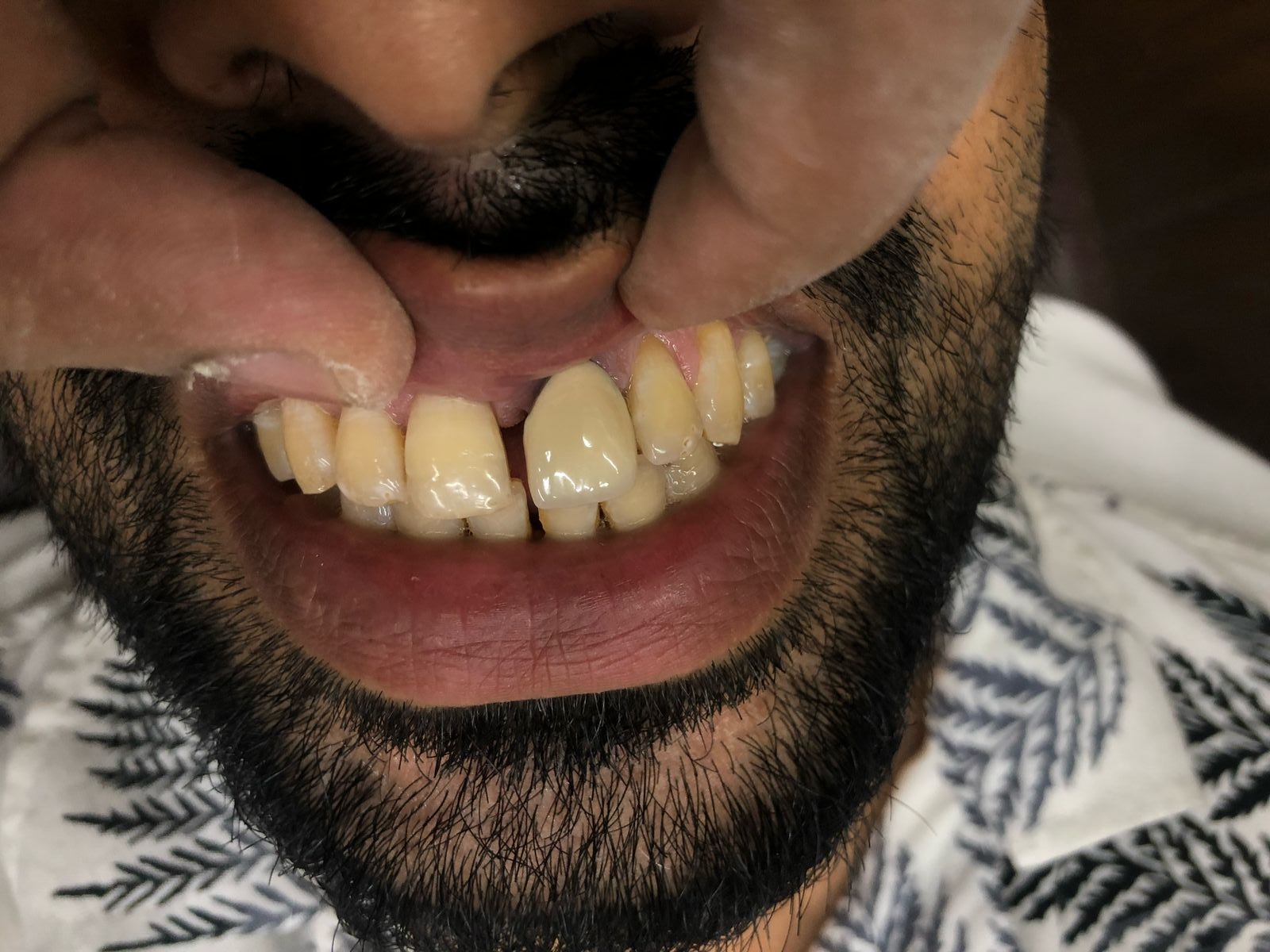 Dr.Nadeer's Fathima Dental Care Vengara