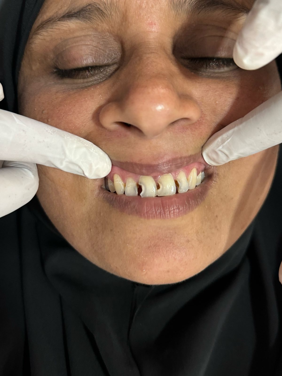 Dr.Nadeer's Fathima Dental Care Vengara
