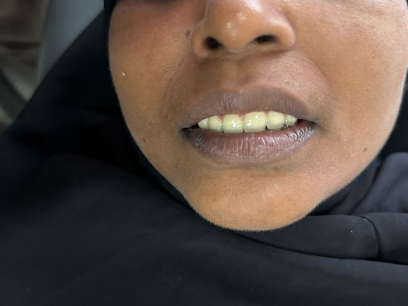 Dr.Nadeer's Fathima Dental Care Vengara